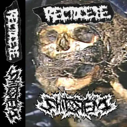 Shitstench : Shitstench & Rectocele